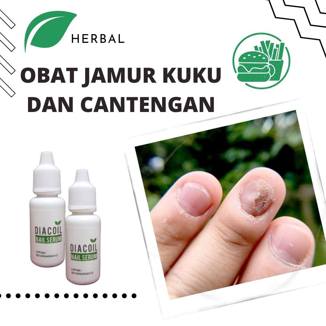 DIACOIL Nail Serum Perawatan Jamur Kuku Kuku Cantengan Kuku Rusak Kuku Bengkak Original 15ml