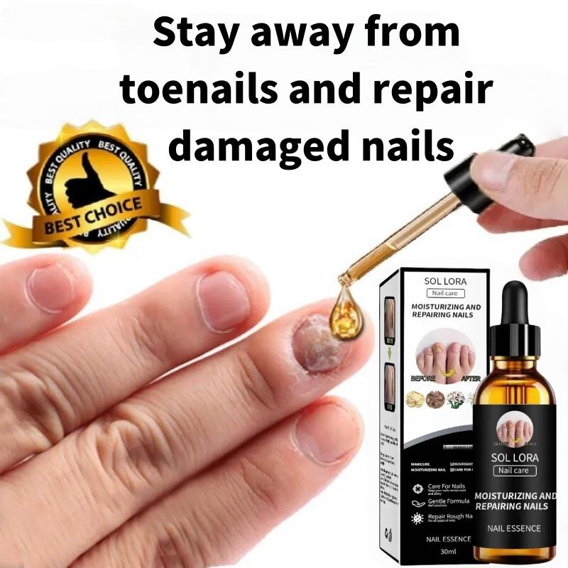 Obat jamur kuku obat kuku jamur dan rusak perawatan kuku nail repair essence serum memperbaiki kuku rusak penghilang jamur kuku perawatan kuku berjamur antibakteri anti lnfeksi kuku