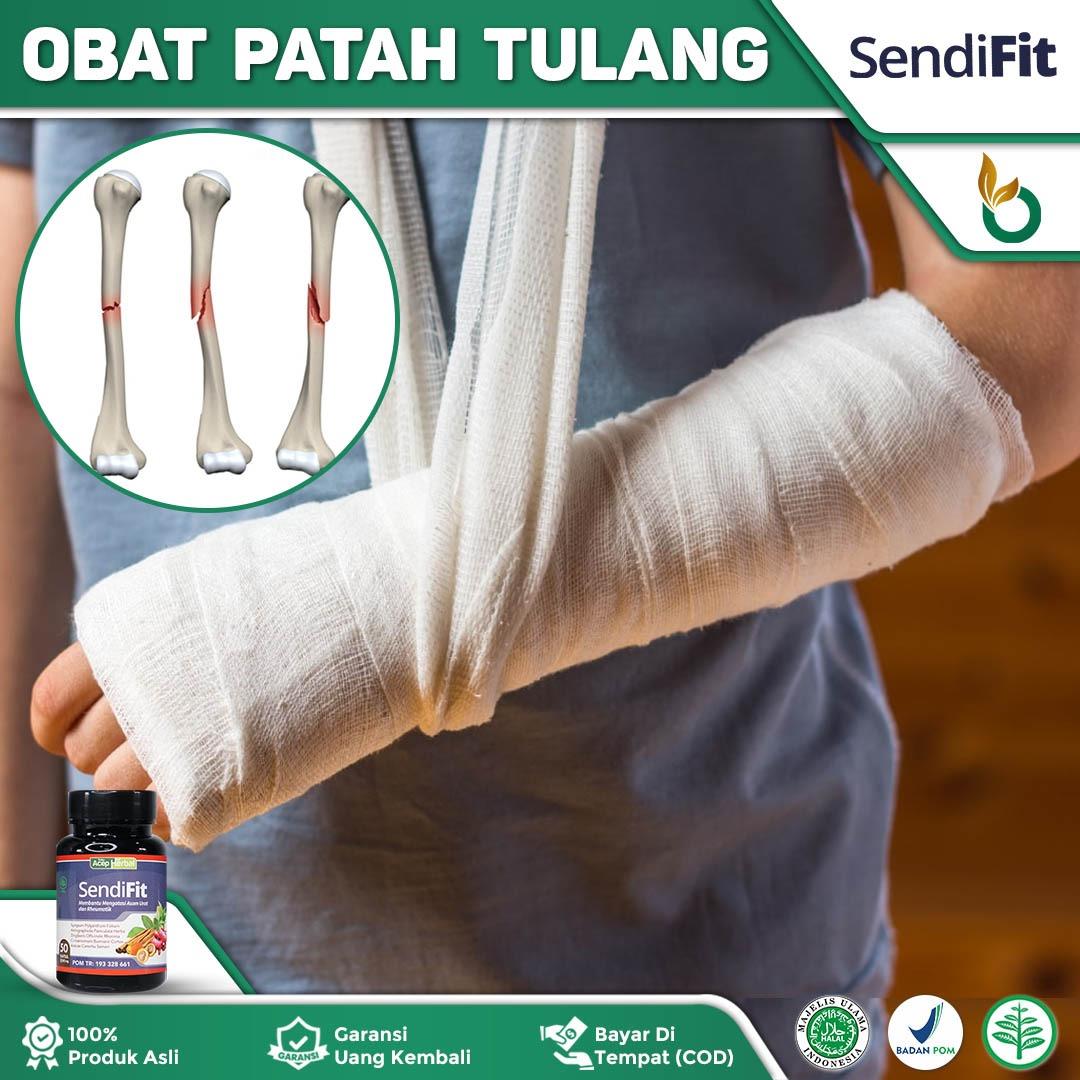 Obat Patah Tulang Akibat Jatuh Kecelakaan Patah Tulang Tangan Patah Tulang Kaki Tulang Patah Tulang Keropos Tulang Retak Tulang Remuk Tulang Ngilu Osteoporosis Osteoarthritis Herbal Patah Tulang Patah Tulang Rusuk - SendiFit Original BPOM