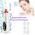 Blackhead Remover Vacuum Pore Cleaner Free Acne Pimple Needles Kit