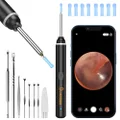 VITCOCO Ear Wax Removal Kit Ear Camera 1920P HD Ear Wax Removal Tool Ear Cleaner Otoscope with 6 LED Lights, 3mm Visual Ear Scope for iPhone iPad Android Smart Phone