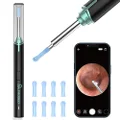 VITCOCO Ear Wax Removal Kit Ear Camera 1920P FHD Wireless Ear Cleaner Ear Wax Remover with 8 PCS Ear Spoon, 3.9mm Waterproof Ear Otoscope Endoscope for iPhone, Ipad & Android Smart Phones
