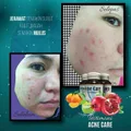 ACNE CARE+FREE GIFT