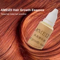 Hair Growth Essence Hair Loss Liquid 20ml Dense Hair Fast Hair Growth Product