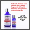 Acne Scars Healing Oil (10ml) Treating Open Pores Blemishes Redness Pimples Skin