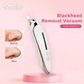 Satoshi Blackheads Removal Vacuum Blackhead Suction Vacuum Pore Deep Cleansing Face Care Device