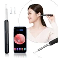 Vicanber HD LED Ear Wax Removal Kit Visual Camera Smart Earwax Cleaner Remover for iPhone iPad & Android (Black)