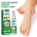 Vicanber 30ml Hands Foot Ringworm Beriberi Fungus Spray Removal Fungus Products (1PC)