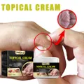 Vicanber 30g Hand Sweat Herpes Cream Foot Anti-itching Bacteriostasis Antipruritic Repair (1PC)