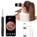 GoodGoods Visual Ear Wax Removal Kit with Endoscope Camera LED HD Smart Bud Cleaner iPhone iPad & Android