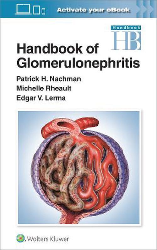 Handbook of Glomerulonephritis