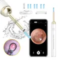 Ear Wax Removal Tool- Ear Cleaner With Camera, Otoscope With Light Ear Wax Removal Kit With 6 Ear Pick, For Iphone, Ipad, Android Phones