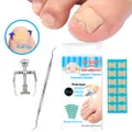 Ingrown Nail Correction Kit Ingrown Toenail Stickers Toe Nail Clamp & Lifter Straightening Treatment Recover Corrector Toe Nail Fingernail Care Tool