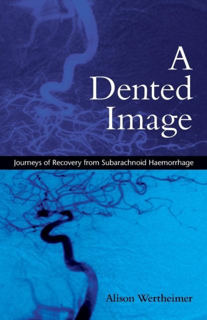 A Dented Image by Alison Wertheimer